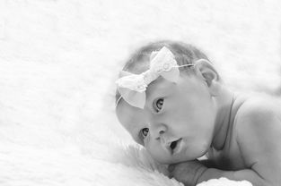 孕期妊娠合并新生儿鸟氨酸转移酶缺乏症怎么低蛋白饮食